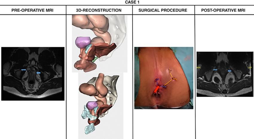 surgical