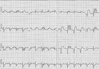cc-epr144