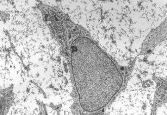 cc-epr382