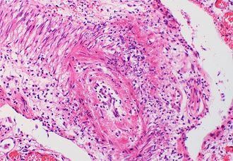cc epr496