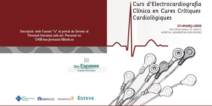 Electrocardiografia clínica en cures crítiques cardiològiques