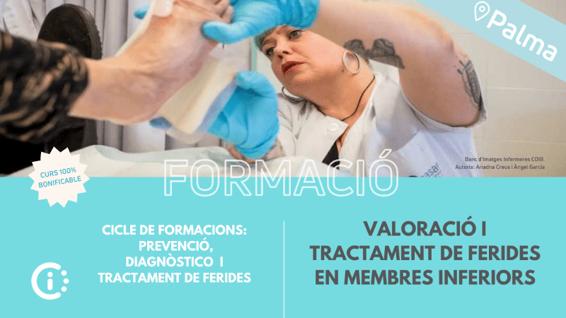 Valoració i Tractament de Ferides en Membres Inferiors