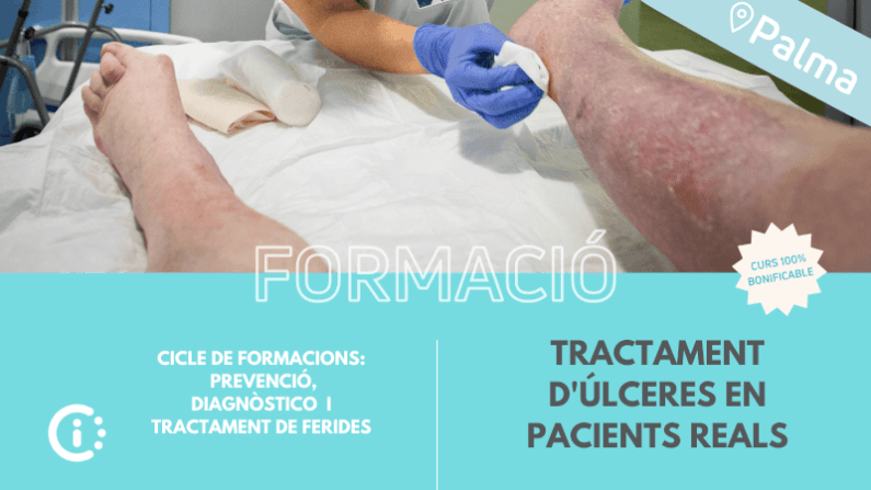 Tractament d'Úlceres en Pacients Reals