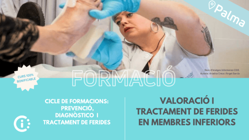 Valoració i Tractament de Ferides en Membres Inferiors